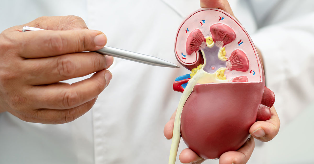 best kidney doctor in Siliguri 